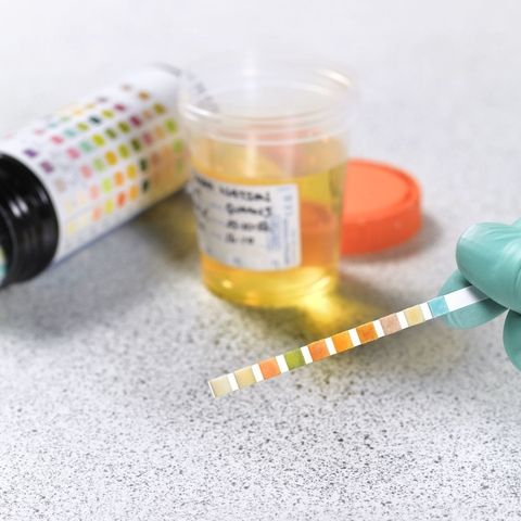PPI Drug Testing by Cambodia, PPI Network, CC BY 2.0, Flickr
